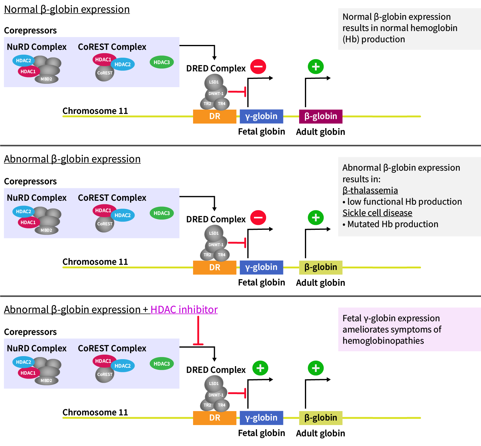 HDACi in hemoglobinopathies